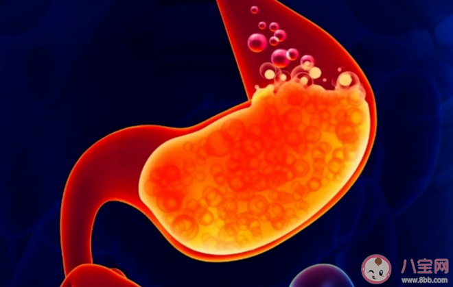 8件事拯救胃食管反流的人 胃食管反流要做哪些檢查