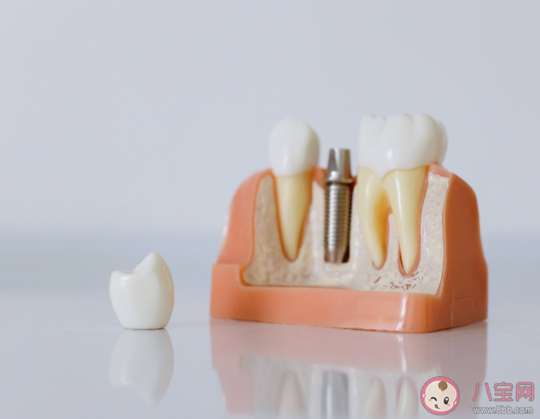 種植牙會干擾影像檢查嗎 種植牙松動了怎么辦