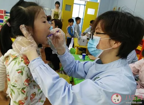 從小涂氟真的能預防齲齒嗎 涂氟后多久能吃東西