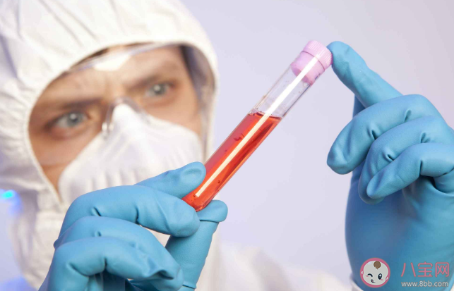 體檢中的血粘度測定有必要做嗎 抽血檢查有什么意義