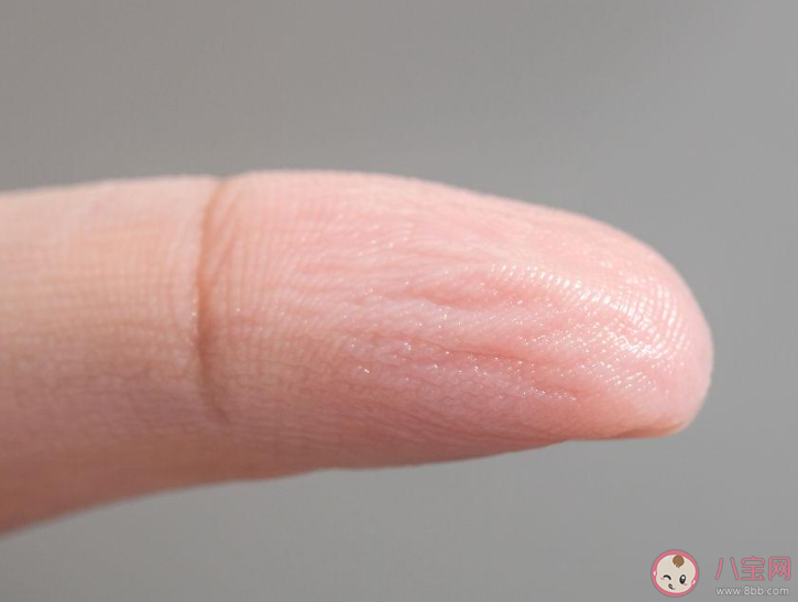 手指長時間泡水會變得皺皺的這是 螞蟻莊園10月9日答案 手指長時間泡水會變得皺皺的這是 螞蟻莊園10月9日答案