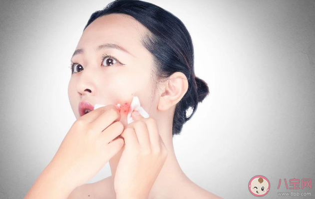 反復長痘其實是濕熱體質引起的 濕熱體質如何調理