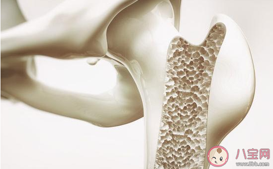 女子每天3杯咖啡被確診骨質疏松 咖啡喝多了會導致骨質疏松嗎