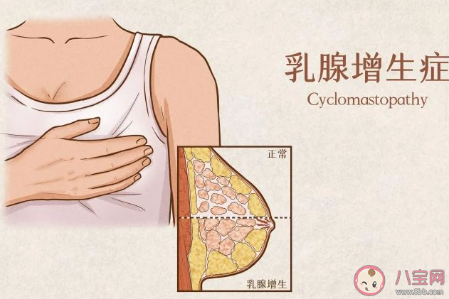 乳腺結節真是氣出來的嗎 乳腺結節離乳腺癌還有多遠