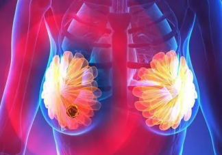 乳腺結(jié)節(jié)真是氣出來的嗎 乳腺結(jié)節(jié)離乳腺癌還有多遠(yuǎn)