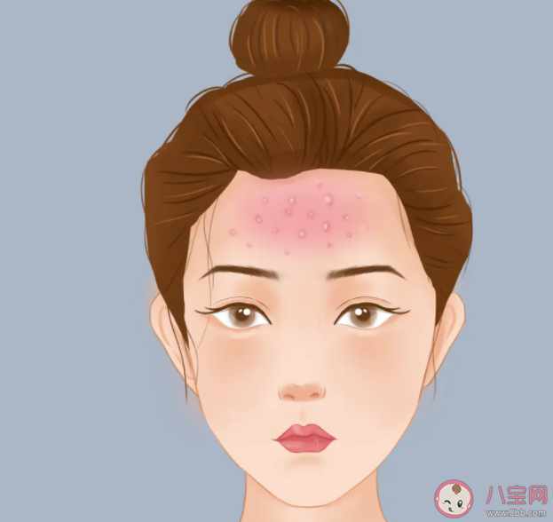 不同部位長(zhǎng)痘各有病根嗎 長(zhǎng)痘與身體器官的聯(lián)系是怎樣的