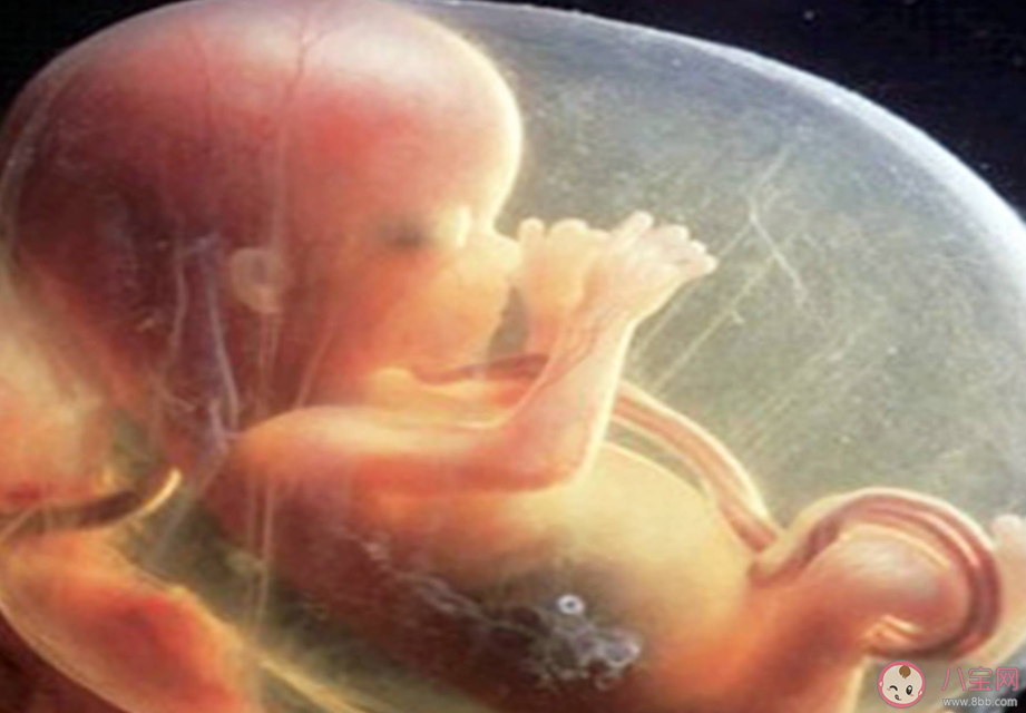 胎兒臍帶繞頸能順產嗎 胎兒臍帶繞頸是什么原因