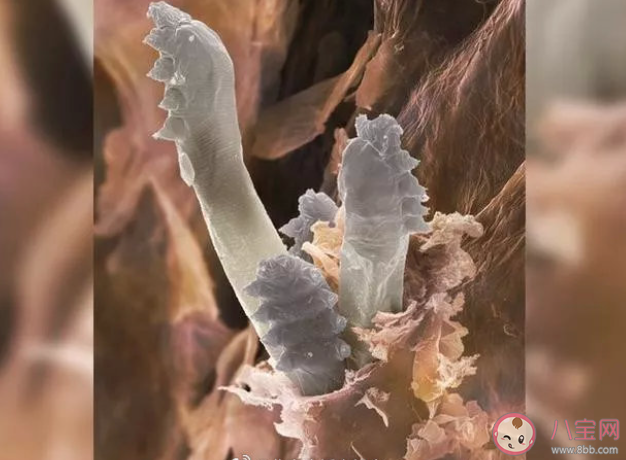 冬季是螨蟲的復(fù)出期嗎 冬季如何消除螨蟲 冬季是螨蟲的復(fù)出期嗎 冬季如何消除螨蟲