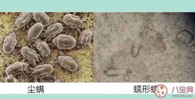 冬季是螨蟲的復(fù)出期嗎 冬季如何消除螨蟲 冬季是螨蟲的復(fù)出期嗎 冬季如何消除螨蟲