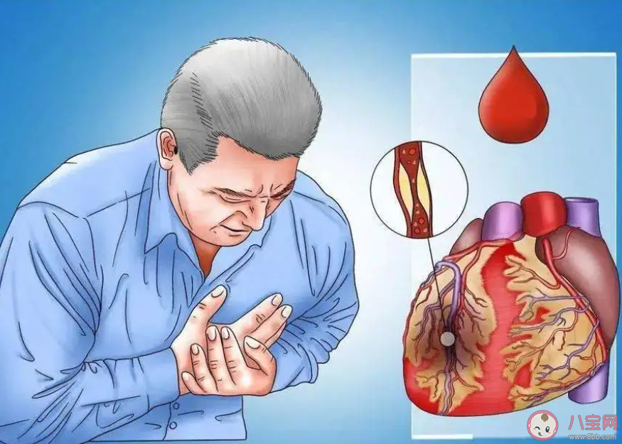 以下哪種生活習慣有助于預防心腦血管疾病 螞蟻莊園11月18日答案 以下哪種生活習慣有助于預防心腦血管疾病 螞蟻莊園11月18日答案