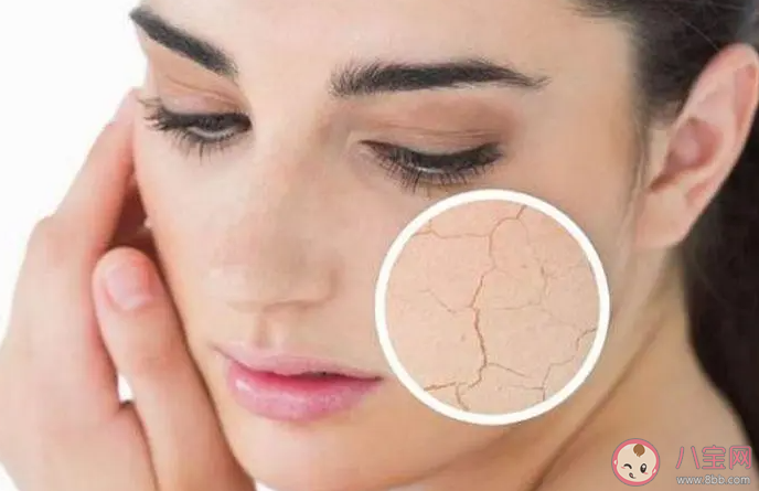 冬季皮膚容易干燥發癢以下哪種辦法有助于改善這種情況 螞蟻莊園11月29日答案 冬季皮膚容易干燥發癢以下哪種辦法有助于改善這種情況 螞蟻莊園11月29日答案