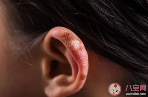 耳朵出現輕微凍傷以下哪種操作更科學 螞蟻莊園12月2日答案介紹 耳朵出現輕微凍傷以下哪種操作更科學 螞蟻莊園12月2日答案介紹