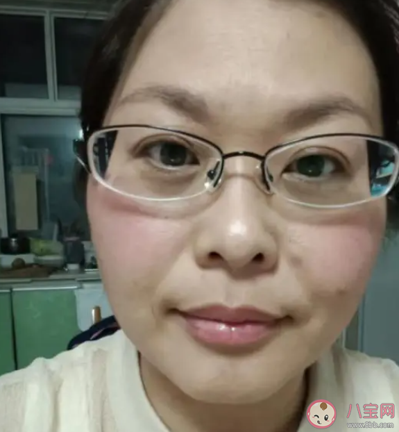 42歲女子20天斷崖式衰老是怎么回事 為什么會出現斷崖式衰老