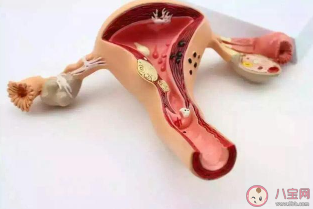 排卵后1周是黃體破裂高危期嗎 如何避免黃體破裂