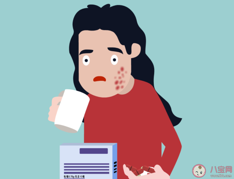 紅斑狼瘡高發人群是年輕女性 為什么會得紅斑狼瘡