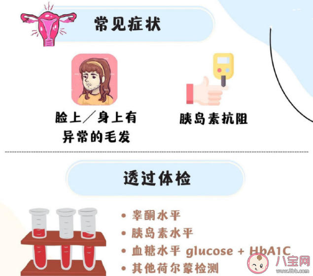 有多囊卵巢綜合征女性會(huì)出現(xiàn)爆痘 多囊卵巢綜合征會(huì)有哪些癥狀