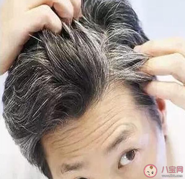 白頭發可能是身體給你的警報 為什么會有白頭發出現