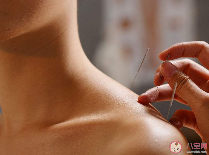 山海經中有石如玉可以為針的記載與哪一種傳統非遺有關 螞蟻新村2月7日答案