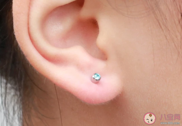 為什么不建議疤痕體質(zhì)打耳洞 疤痕體質(zhì)哪些事情不能做