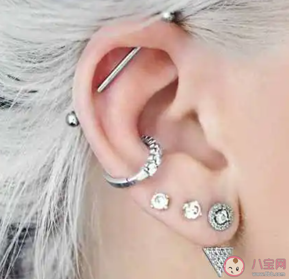 為什么不建議疤痕體質(zhì)打耳洞 疤痕體質(zhì)哪些事情不能做
