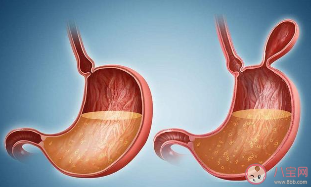 養(yǎng)胃到底怎么養(yǎng) 養(yǎng)胃能不能喝粥