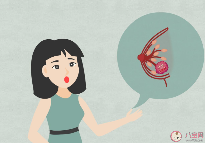 懷孕前一定要對乳房做全面檢查嗎 乳腺結節是如何產生的