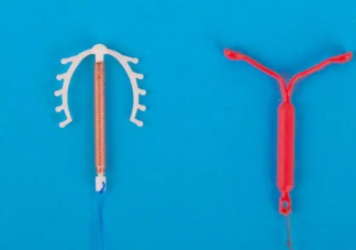 節育環真的是讓子宮不斷發炎來避孕嗎 節育環過了保質期一定要取出嗎