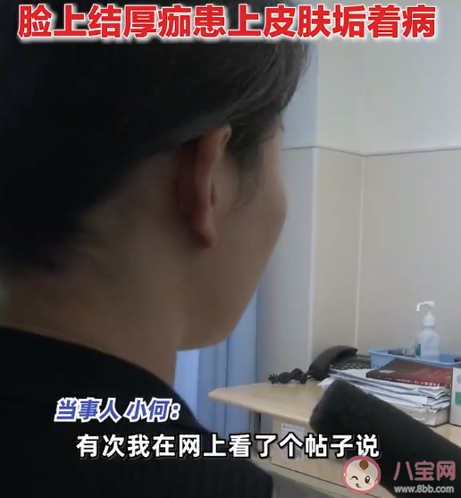 女子為護膚1個月不洗臉致滿臉結痂 長時間不洗臉會怎樣