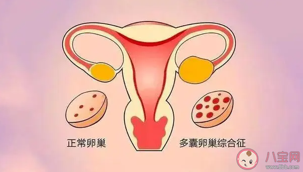 為什么卵巢對女人如此重要 卵巢早衰有哪些癥狀