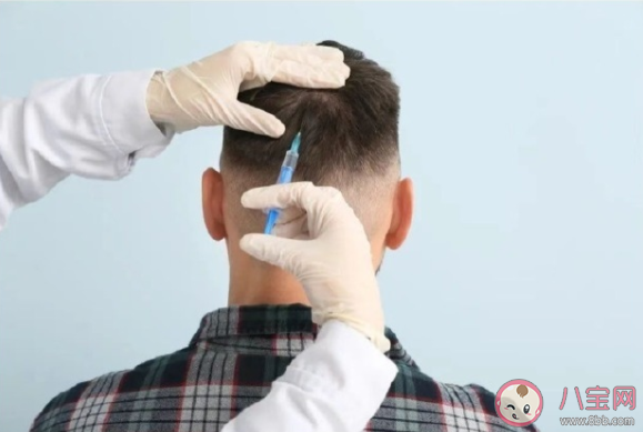 為什么有人禿頭但腿毛特長 腿毛可以移植到頭上嗎