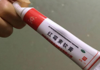 醫生溫馨提示不要碰這些藥膏 日常需要準備哪些藥膏